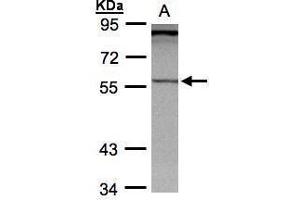 PCCB antibody  (Center)