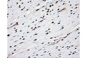 Immunohistochemical staining of paraffin-embedded liver tissue using anti-ACSBG1 mouse monoclonal antibody. (ACSBG1 antibody)