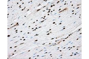 Immunohistochemical staining of paraffin-embedded liver tissue using anti-ACSBG1 mouse monoclonal antibody.