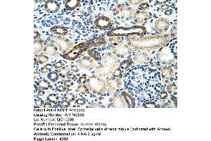 Rabbit Anti-HNRPF Antibody  Paraffin Embedded Tissue: Human Kidney Cellular Data: Epithelial cells of renal tubule Antibody Concentration: 4. (HNRNPF antibody  (C-Term))