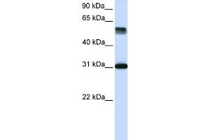 WB Suggested Anti-TRIM31 Antibody Titration: 0. (TRIM31 antibody  (Middle Region))