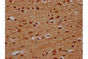 IHC image of ABIN7164105 diluted at 1:600 and staining in paraffin-embedded human brain tissue performed on a Leica BondTM system.