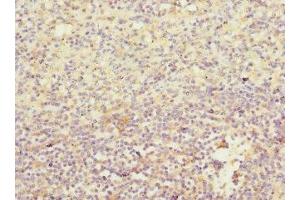 Immunohistochemistry of paraffin-embedded human spleen tissue using ABIN7156851 at dilution of 1:100 (IL21 Receptor antibody  (AA 20-240))