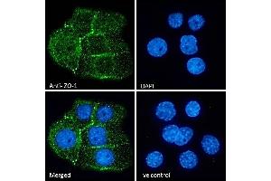 (ABIN570961) Immunofluorescence analysis of paraformaldehyde fixed A431 cells, permeabilized with 0.