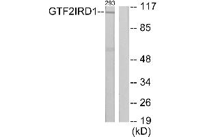 Western blot analysis of extracts from 293 cells, using GTF2IRD1 antibody. (GTF2IRD1 antibody)