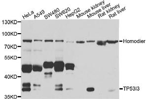 Western blot analysis of extracts of various cell lines, using TP53I3 antibody (ABIN5974745) at 1/1000 dilution. (TP53I3 antibody)