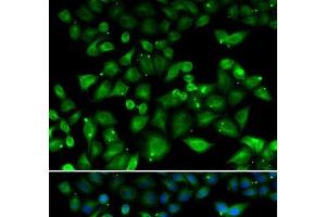 Immunofluorescence analysis of HeLa cells using NHLRC1 Polyclonal Antibody (NHLRC1 antibody)