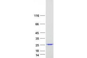 Western Blotting (WB) image for Amino-terminal Enhancer of Split (AES) (Transcript Variant 2) protein (Myc-DYKDDDDK Tag) (ABIN2714442)