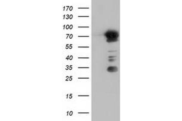 ARHGAP25 antibody