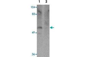 Western blot analysis of human brain tissue with PPAPDC1A polyclonal antibody  at 1 ug/mL in (Lane 1) the absence and (Lane 2) the presence of blocking peptide.