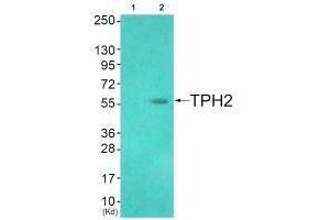 Western blot analysis of extracts from HuvEc cells (Lane 2), using TPH2 (Ab-19) antiobdy. (Tryptophan Hydroxylase 2 antibody  (Ser19))