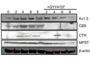 Representative western blots for native IKur/Kv1.