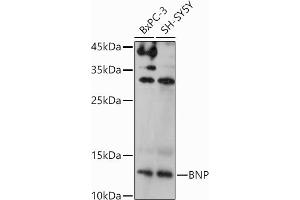 Western blot analysis of extracts of various cell lines, using BNP antibody (ABIN3023135, ABIN3023136, ABIN3023137, ABIN1513273 and ABIN6219406) at 1:1000 dilution.