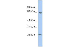 WB Suggested Anti-SCMH1 Antibody Titration:  0. (SCMH1 antibody  (Middle Region))