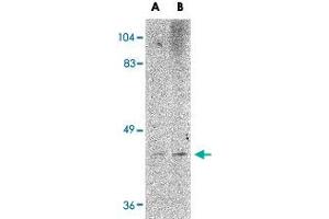 Western blot analysis of LASS6 in rat brain tissue lysate with LASS6 polyclonal antibody  at (A) 1 and (B) 2 ug/mL . (CERS6 antibody  (N-Term))