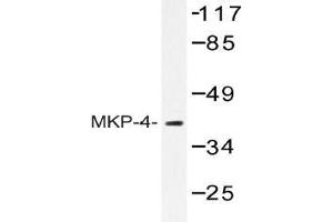 Western blot (WB) analysis of MKP-4 antibody in extracts from HeLa cells. (DUSP9 antibody)