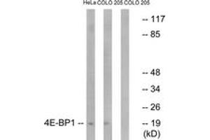 Western blot analysis of extracts from HeLa/COLO205 cells, treated with EGF 200ng/ml 5', using 4E-BP1 (Ab-45) Antibody. (eIF4EBP1 antibody  (AA 13-62))