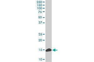 RPL36A monoclonal antibody (M02), clone 6H1. (RPL36A antibody  (AA 7-106))