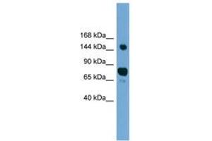 Image no. 1 for anti-ATP/GTP Binding Protein 1 (AGTPBP1) (AA 287-336) antibody (ABIN6745085) (AGTPBP1 antibody  (AA 287-336))