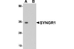 Western Blotting (WB) image for anti-Synaptogyrin 1 (SYNGR1) (Middle Region) antibody (ABIN1031113)