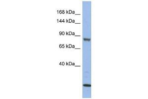 MAP3K11 antibody used at 1 ug/ml to detect target protein. (MAP3K11 antibody  (Middle Region))