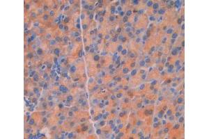 Used in DAB staining on fromalin fixed paraffin- embedded Kidney tissue (UPP1 antibody  (AA 1-277))