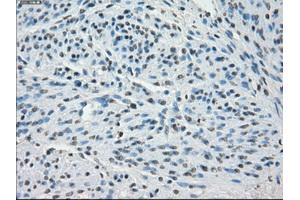 Image no. 2 for anti-Synovial Sarcoma, X Breakpoint 2 (SSX2) antibody (ABIN1501162) (SSX2 antibody)