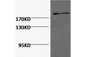 Western Blot analysis of Hela cells using FN1 Monoclonal Antibody at dilution of 1:2000. (Fibronectin 1 antibody)