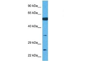 Host:  Rabbit  Target Name:  TMEM158  Sample Tissue:  Human U937 Whole Cell  Antibody Dilution:  1ug/ml (TMEM158 antibody  (Middle Region))