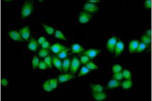 Immunofluorescence staining of Hela cells with ABIN7151576 at 1:166, counter-stained with DAPI. (ELP2 antibody  (AA 323-457))