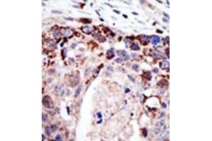 Image no. 2 for anti-Ataxin 3 (ATXN3) (N-Term) antibody (ABIN357621) (Ataxin 3 antibody  (N-Term))