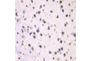 Immunohistochemistry of paraffin-embedded mouse brain using PRMT5 antibody (ABIN5970714) at dilution of 1/100 (40x lens). (PRMT5 antibody)