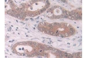Immunohistochemistry (IHC) image for anti-NAD(P)H Dehydrogenase, Quinone 1 (NQO1) (AA 2-274) antibody (ABIN7430126)