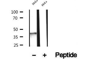 Western blot analysis of extracts of HeLa cells, using NSDHL antibody. (NSDHL antibody  (Internal Region))
