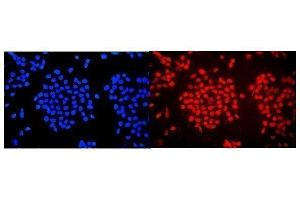 IF analysis of WAC using anti-WAC antibody (ABIN7601789). (WAC antibody  (AA 459-647))