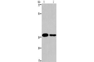 Western Blotting (WB) image for anti-SNAIL (SNAI1) antibody (ABIN2428727) (SNAIL antibody)