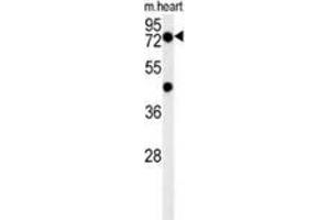 Western blot analysis in mouse heart tissue lysates (15ug/lane) using PHTF2 Antibody . (PHTF2 antibody  (Middle Region))