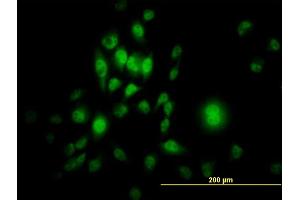 Immunofluorescence of monoclonal antibody to SP1 on HeLa cell. (SP1 antibody  (AA 89-198))