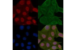 HER2/ErbB2 Mouse Monoclonal Antibody staining Hela cells by IF/ICC. (ErbB2/Her2 antibody  (Internal Region))