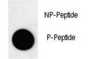Dot Blot (DB) image for anti-Microtubule-Associated Protein 1 Light Chain 3 beta (MAP1LC3B) (pThr29) antibody (ABIN3031788)
