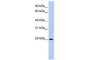 WB Suggested Anti-DNASE2B Antibody Titration:  0. (DNASE2B antibody  (Middle Region))