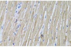 Immunohistochemistry of paraffin-embedded Rat heart using P2RY2 Polyclonal Antibody at dilution of 1:100 (40x lens). (P2RY2 antibody)