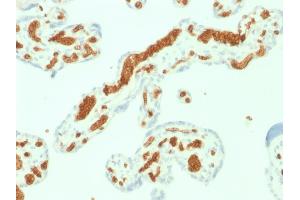 Formalin-fixed, paraffin-embedded human Placenta stained with Spectrin alpha 1 (SPTA1) Mouse Monoclonal Antibody (SPTA1/1832). (SPTA1 antibody  (AA 356-475))