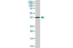 PCYT1A monoclonal antibody (M03), clone 7H8. (PCYT1A antibody  (AA 2-90))