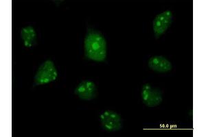 Immunofluorescence (IF) image for anti-C1D Nuclear Receptor Corepressor (C1D) (AA 1-141) antibody (ABIN2565382)