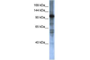 WB Suggested Anti-SMARCAL1 Antibody Titration:  0. (SMARCAL1 antibody  (Middle Region))