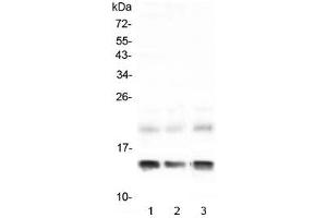 Western blot testing of 1) rat liver, 2) rat RH35 and 3) mouse liver lysate with FABP1 antibody at 0. (FABP1 (liver) antibody)