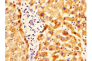 IHC image of ABIN7162288 diluted at 1:400 and staining in paraffin-embedded human liver tissue performed on a Leica BondTM system. (OTC antibody  (AA 33-354))