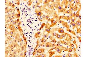 IHC image of ABIN7162288 diluted at 1:400 and staining in paraffin-embedded human liver tissue performed on a Leica BondTM system. (OTC antibody  (AA 33-354))