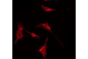 ABIN6274584 staining HuvEc by IF/ICC. (beta 2 Adrenergic Receptor antibody  (C-Term))
